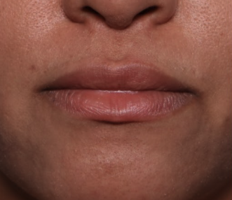 Case # 9 after photo