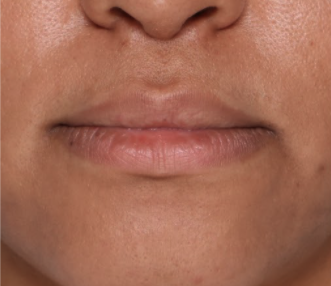 Case # 9 before photo