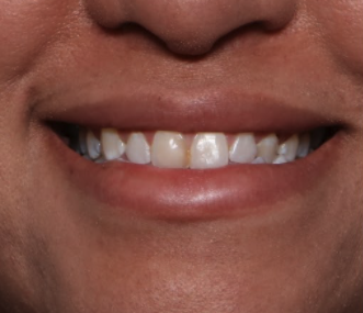 Case # 9 after photo