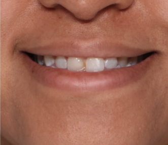 Case # 9 before photo