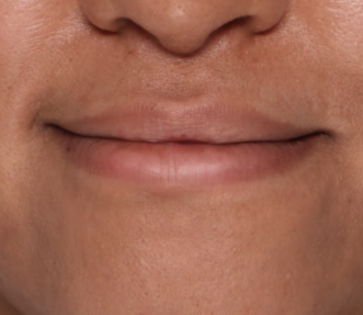 Case # 9 before photo