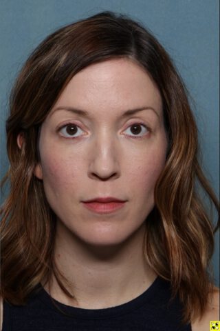 Case # 1 after photo