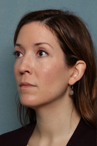 Case # 1 before photo