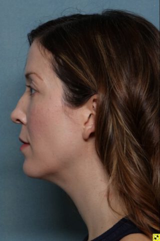 Case # 1 after photo