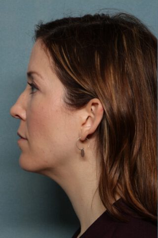 Case # 1 before photo