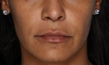 Case # 16 after photo