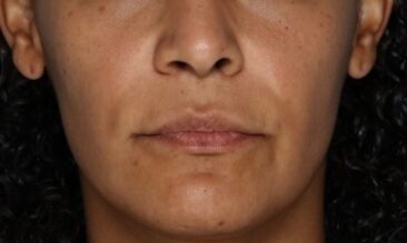 Case # 16 before photo