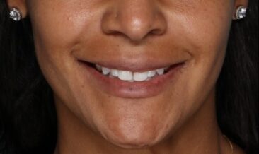 Case # 16 after photo