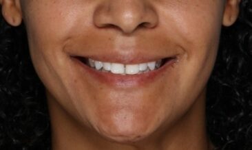 Case # 16 before photo