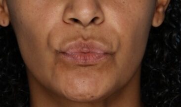 Case # 16 before photo