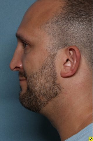 Case # 2 after photo