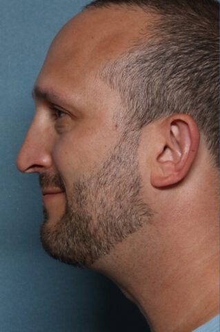 Case # 2 before photo