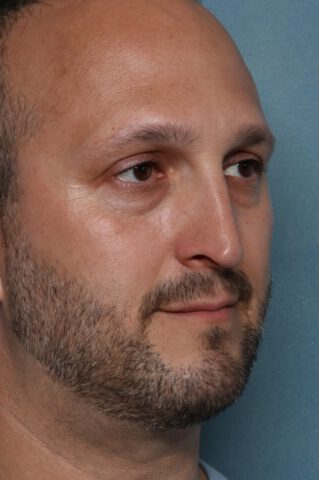 Case # 2 before photo