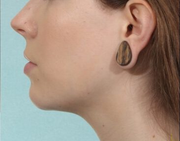 Case # 12 after photo