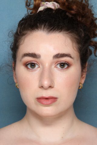 Case # 1 after photo