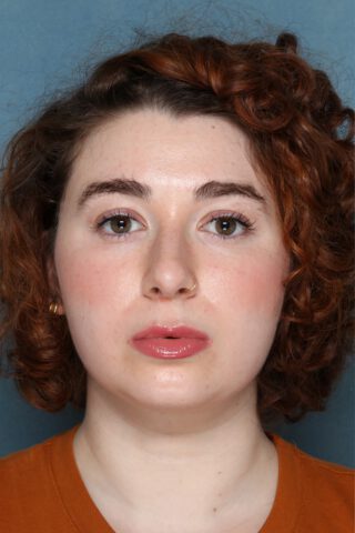 Case # 1 before photo