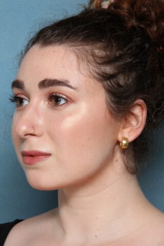 Case # 1 after photo