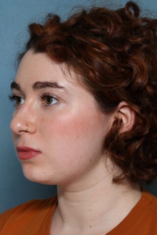 Case # 1 before photo