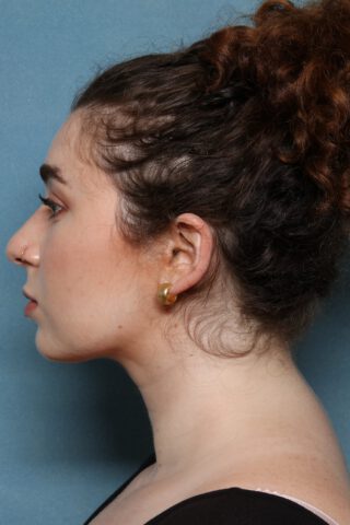 Case # 1 after photo