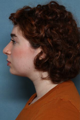 Case # 1 before photo