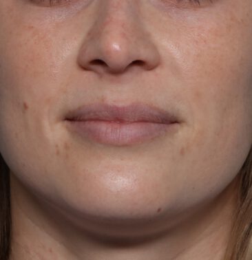 Case # 20 before photo