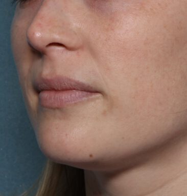 Case # 20 before photo