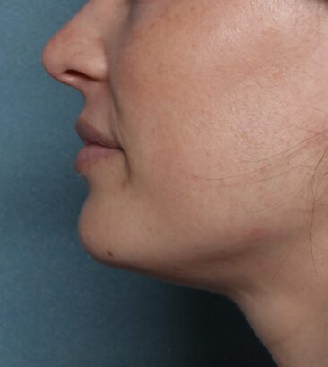 Case # 20 before photo