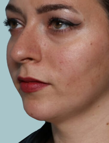 Case # 8 after photo