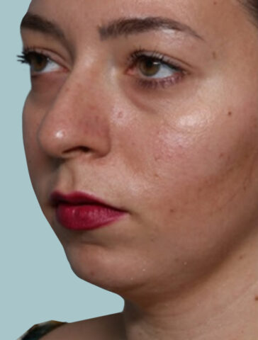 Case # 8 before photo