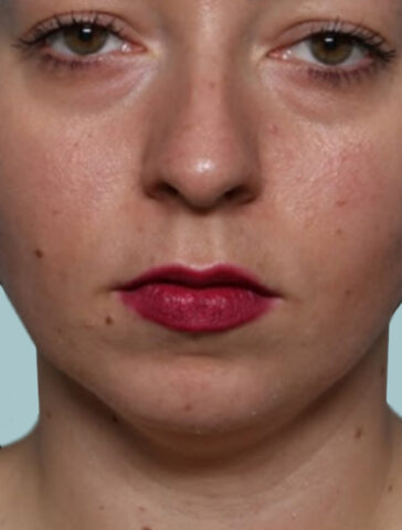 Case # 8 before photo