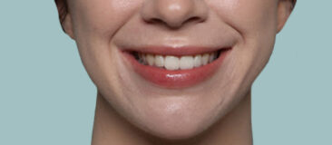 Case # 14 after photo