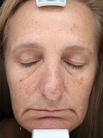 Case # 21 before photo