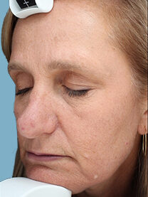 Case # 21 after photo