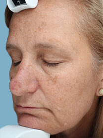 Case # 21 before photo