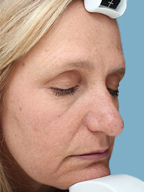 Case # 21 after photo