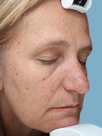 Case # 21 before photo