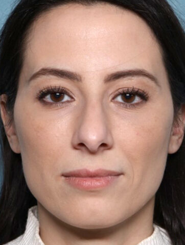 Case # 7 after photo