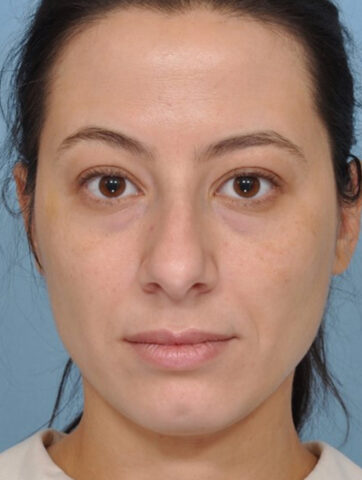 Case # 7 before photo