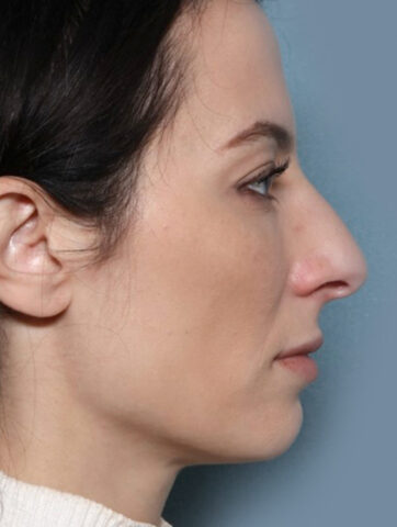 Case # 7 after photo