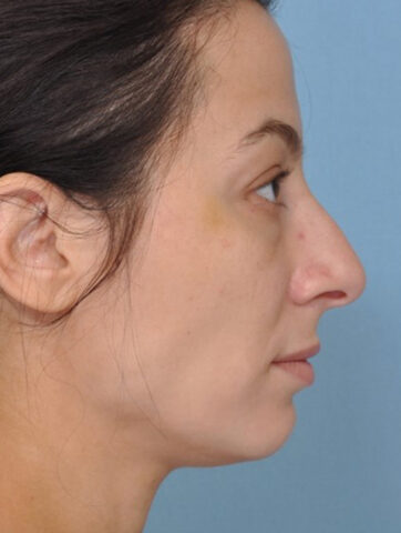 Case # 7 before photo