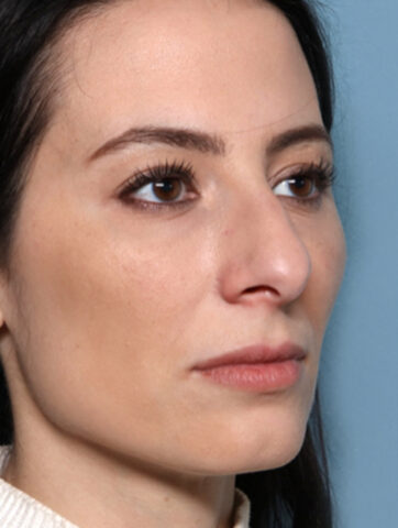 Case # 7 after photo