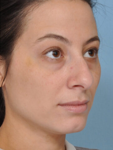 Case # 7 before photo