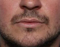 Case # 5 before photo