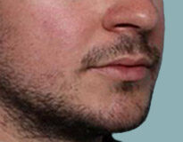 Case # 5 before photo