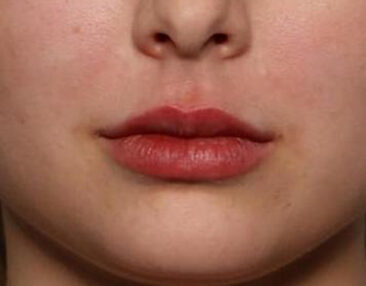 Case # 6 after photo