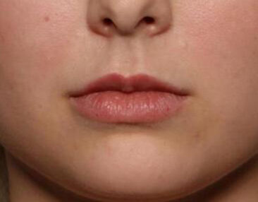 Case # 6 before photo