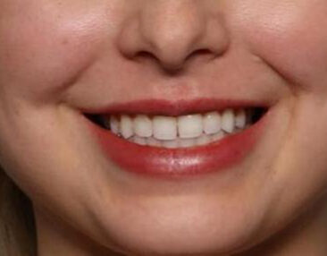 Case # 6 after photo