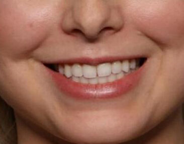 Case # 6 before photo