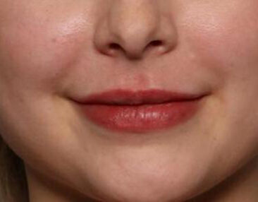 Case # 6 after photo