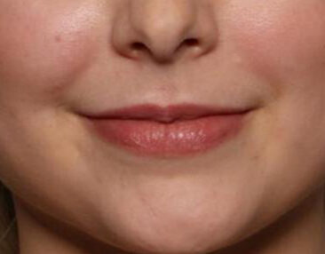 Case # 6 before photo